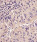 ACSL4 (FACL4) Antibody (Center)